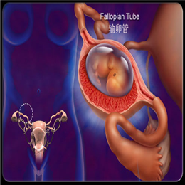 引起女性宫外孕的原因