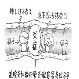 输卵管炎能治好吗