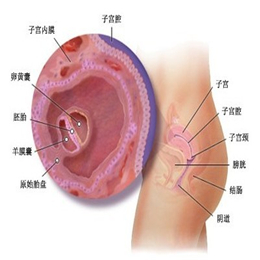 子宫内膜息肉有什么症状
