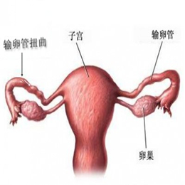输卵管性不孕的治疗方法