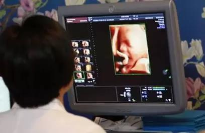 孕早期注意事项